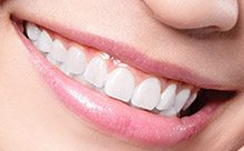 cosmetic_dentistry-3